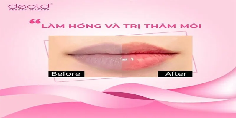 Deold - Cách phân biệt hàng giả, hàng nhái