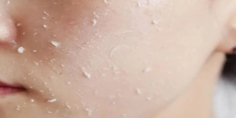 5 bước đơn giản để có làn da đẹp ngay tại nhà